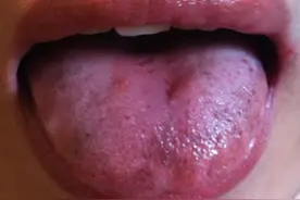 活血不疏肝，瘀血堵到底！血府逐瘀丸用得好，疏肝活血一步到位图片