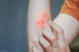 家家都有的云南白药！除了治疗跌打损伤，还能治这些常见症！图片