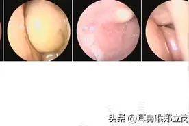 严重鼻塞，睡不了觉，居然这样解决了图片