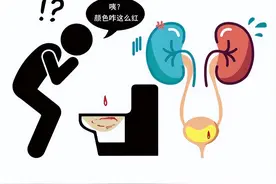 小小的尿常规，能查出什么疾病呢？图片