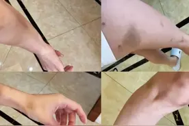心痛！母亲见孩子被全家暴打！强拧手臂，浑身淤青，被打致脑震荡图片