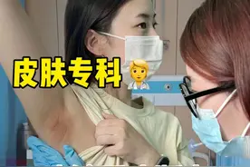 祛狐臭经历大曝光！腋下秒变清爽无异味，别在乱折腾了！图片