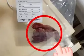 连云港一女子腹痛4年体内惊现纱布！纱布已和结肠及子宫粘连，腐烂无法剥离，家属疑手术遗留，当地：正调查图片