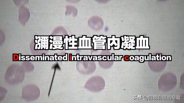 巴西黄鱼胶多少钱一斤 2026年巴西鱼胶便宜吗
