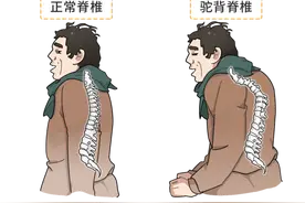 不算很老，背却先驼了？不想驼背，坚持这2个方法，帮助挺直腰杆图片