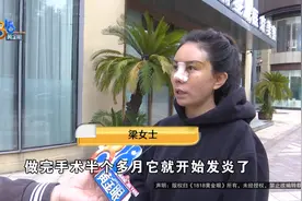 做完“肋骨鼻”一年后，体内发现“大量纱布”？图片