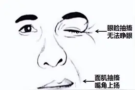 面部老是跳是哪里出现了问题？快速缓解有方法！图片