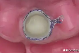 抚宁区人民医院违反医疗器械监督管理条例被处罚图片