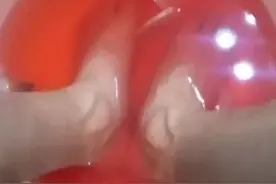 脑梗脑溢血患者，患病后有没有流过泪？出现大小便憋不住的情况？图片