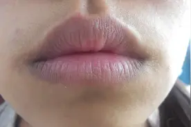 看嘴唇颜色 知道身体病症 你都了解么？图片
