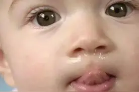孩子感冒都好了，为什么还在流鼻涕？吃什么药才能好得快？图片