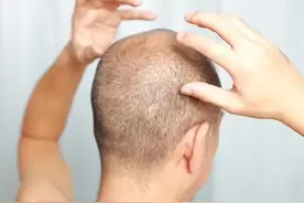 今天才知道，男人尽量不要剃光头！三大原因，让人恍然大悟。图片