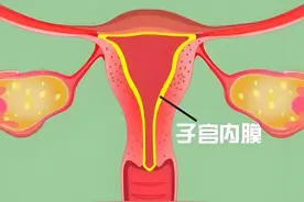 子宫内膜厚、月经来了就不走，这个方子让内膜悄悄剥脱！图片