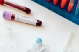 控制高血磷，拒绝血管钙化图片