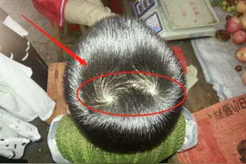 为什么有的孩子头上有“2个旋”，代表什么意思？父母要了解下图片