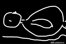 长期卧床，最容易长褥疮！而屁股小更是糟糕，严重能腐烂到骨！图片