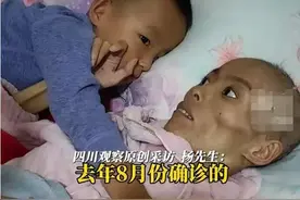 太可怜了！29岁女子癌症前后判若两人，4岁儿子呼喊妈妈让人心碎图片