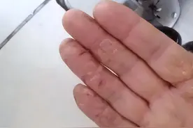 公认皲裂膏测评分享！碾压一众大牌的竟是它，一周远离干裂爆皮！图片