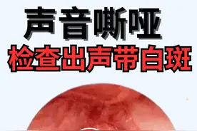 声音嘶哑一检查是声带白斑，这个严重吗图片