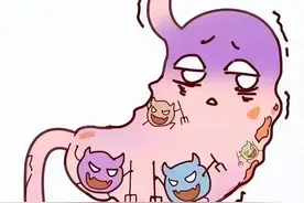 胃痛？灼热感？食欲减退？小心消化性溃疡！5种情况都易溃疡！图片