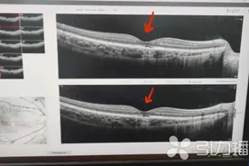 把激光笔当玩具？苏州医生提醒：会对儿童造成永久视力损伤图片