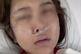 太炸裂!女子丰臀注射了400支玻尿酸，屁股开始化水，网友:是狠人!图片