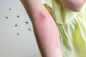 健康科普|小风团大麻烦，荨麻疹该如何应对？图片