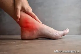 多替诺雷是治疗高尿酸血症、痛风的新药，与非布司他有什么区别？图片