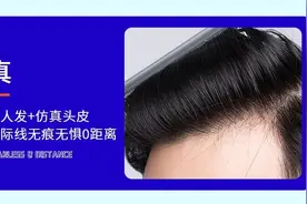 你知道防脱发生发的最好办法吗图片
