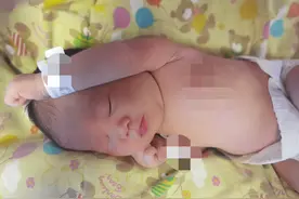 新生宝宝黄疸高究竟要不要住院照蓝光？图片