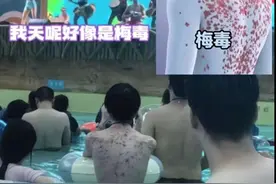 水上乐园堪称病菌培养皿 你还敢去吗图片