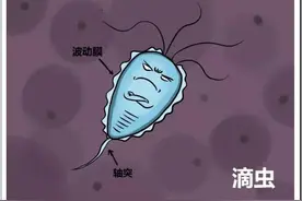 滴虫性阴道炎！快看图片