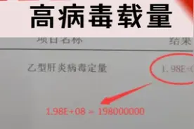 乙肝病毒定量多高算高？一次性讲清楚！图片