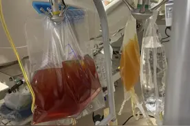 老婆景区里采了6朵蘑菇，老公吃完住进ICU！医生仔细一看：1朵足可致命图片