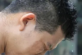 头汗特别多，像水洗过的一样，是身体哪里出了问题了？该怎么办？图片