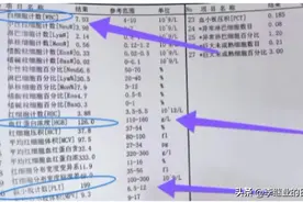 血常规出现一高一低，百分之八十是大病前兆！图片