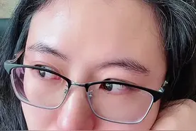 段睿头发已白，或因陪同蔡磊与渐冻症的斗争已身心俱疲图片