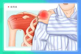 有一种疼痛，是肩周炎，中医教您“揉7灸3”，快速告别“五十肩”图片