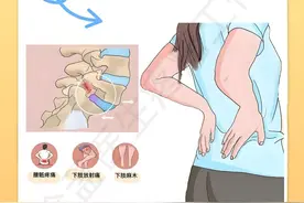 告别梨状肌紧绷，四大妙招你学会了吗？图片