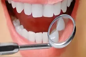 补牙材料贵的和便宜的，怎么选才是好的？图片