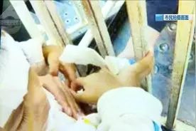 一脚踩过去，女童脚卡在小区滑梯护栏中，出不来了……图片