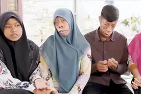 印尼男子“马脸人身”，基因太强遗传3代，子女有苦说不出！图片