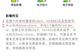CT报告怎么看？实性结节标注为硬结灶，表明结节安全无需复查图片