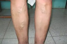 70岁以后还能活多久，看腿部就知?若出现这3个症状，或寿命不长?图片