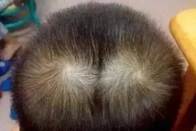 孩子头顶“两个旋”，到底代表什么？很多父母不懂，看完涨知识图片