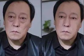 别划走！如果你有眼袋而又打算做手术的话，一定要看完下面几点图片