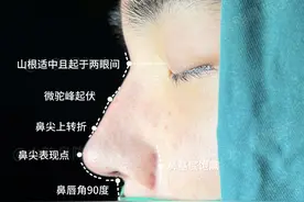 男生想做鼻整形怎么选择材料？注射还是动刀图片