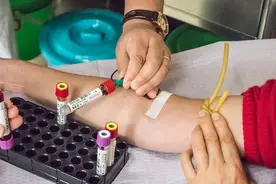 体检不做这4项检查，相当于白做，得了癌症都不知道图片