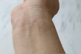 不小心被猫抓了，该怎么办呢？别急，看完就知道了！图片