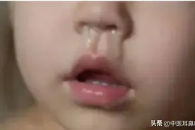 不分季节流鼻涕，打喷嚏，是在提醒你，阳气虚到底了！图片